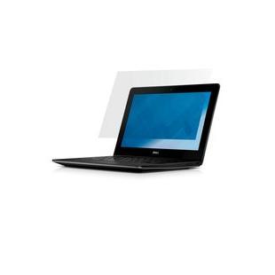 3M Anti-Glare Framed Filter for Dell Chromebooks