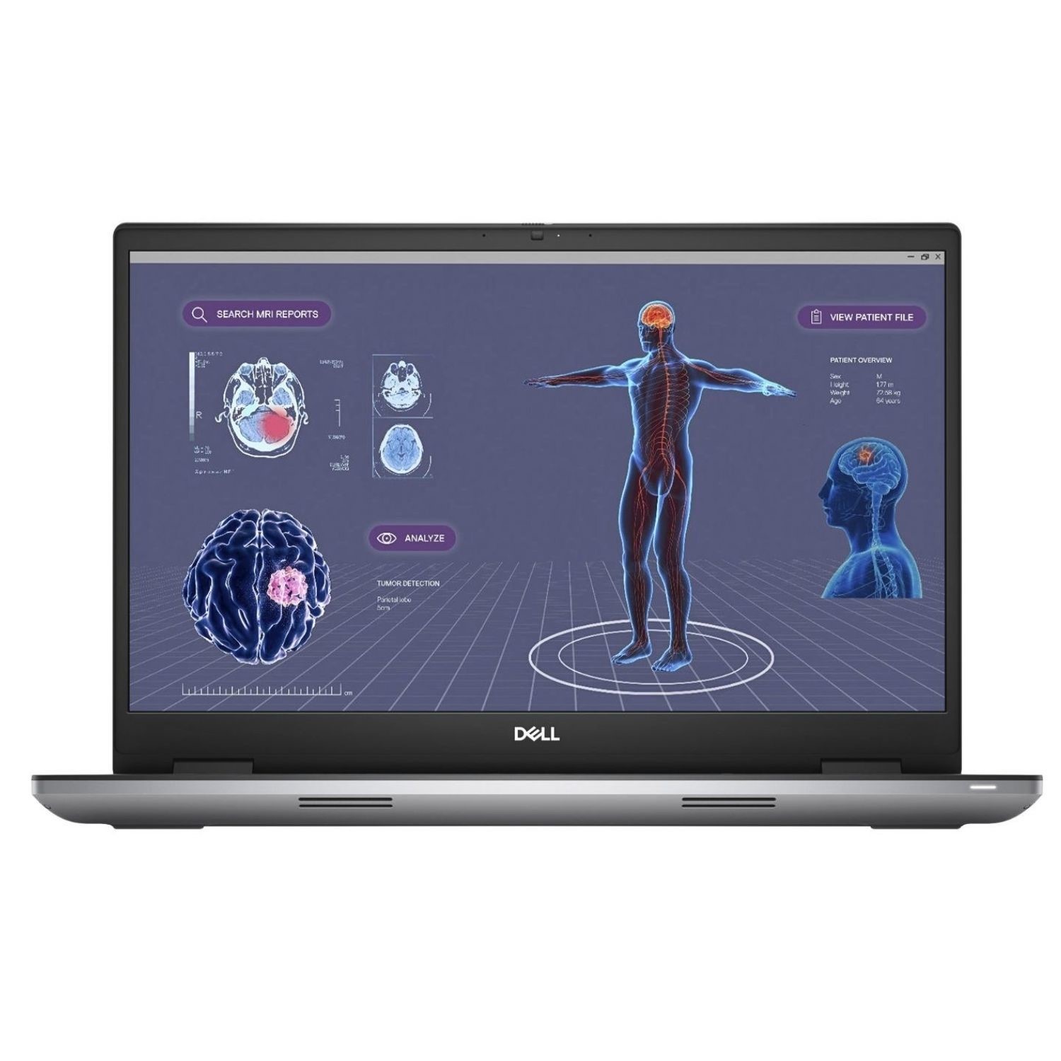 Dell Precision 7780 Intel Core i9 32GB RAM 1TB SSD RTX 3500 12GB 17.3 Inch Windows 11 Pro Laptop
